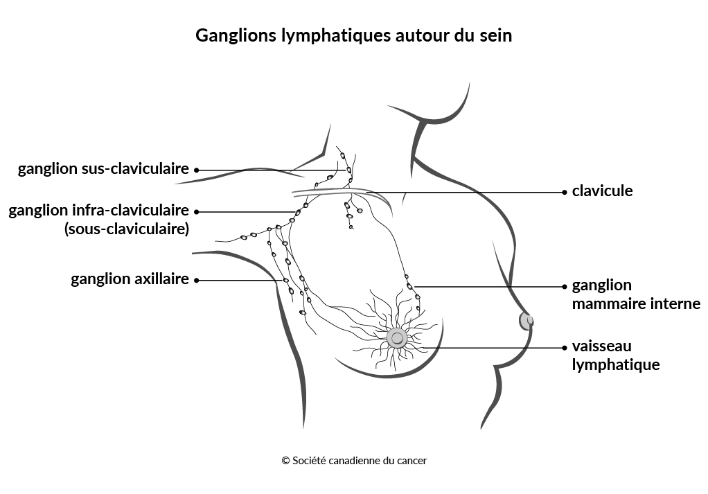 Schéma des ganglions lymphatiques entourant le sein