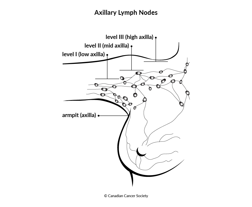 Diagram of axillary lymph nodes