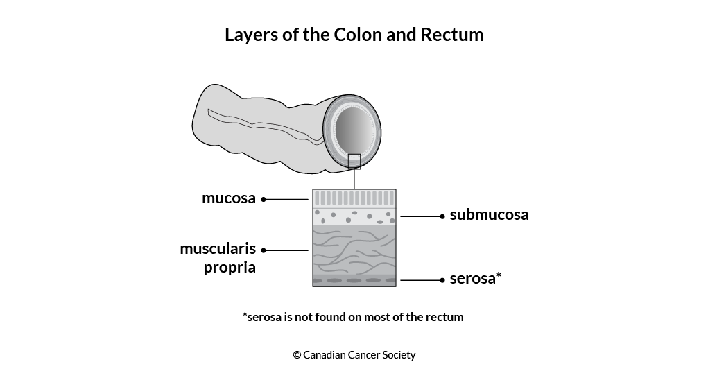 Diagram of the layers of the colon and the rectum