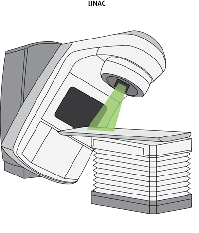 Schéma de l'accélérateur linéaire, ou LINAC