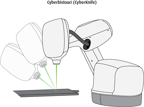 Schéma du cyberbistouri, ou CyberKnife