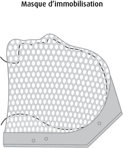 Schéma d'un masque d'immobilisation