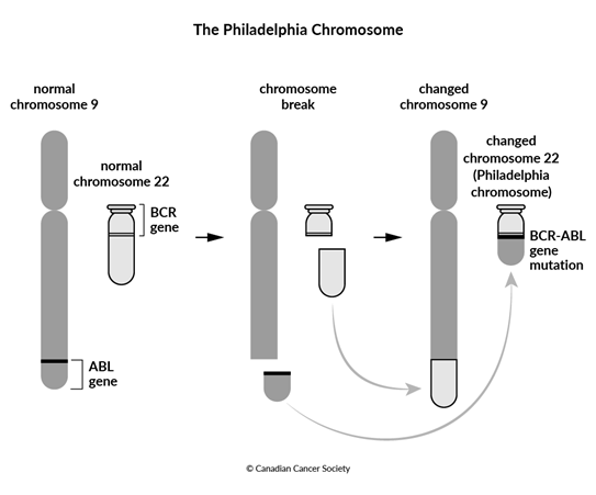 Diagram of the Philadelphia Chromosome