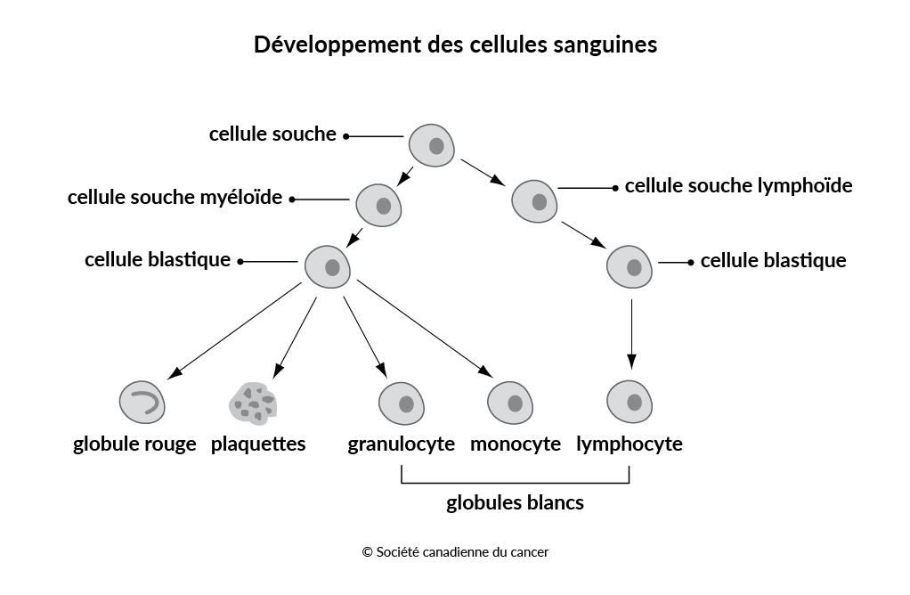 Qu鈥檈st-ce Que La Leuc茅mie My茅lo茂de Aigu毛? | Soci茅t茅 Canadienne Du Cancer