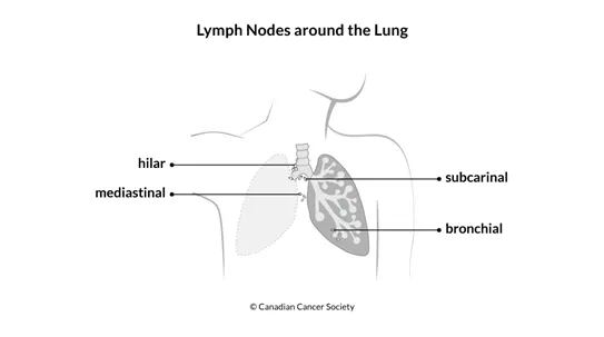 Diagram of the lymph nodes around the lung