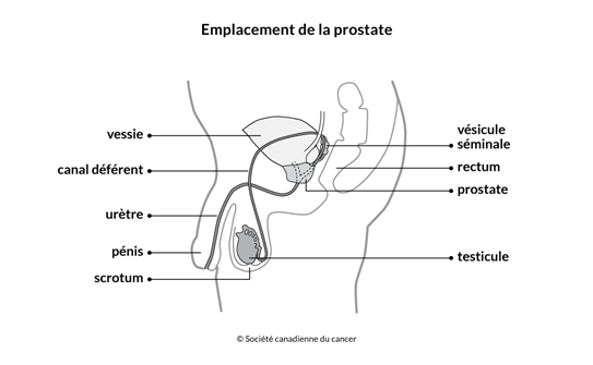 Schéma de l'emplacement de la prostate