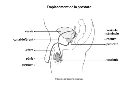 Schéma de l'emplacement de la prostate