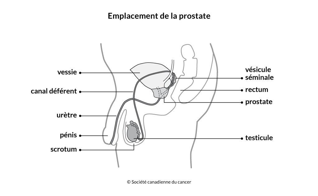 Schéma de l'emplacement de la prostate