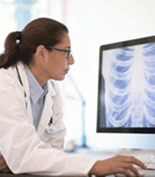 Une femme médecin assise à son bureau regardant le radiogramme d’un thorax sur son ordinateur.
