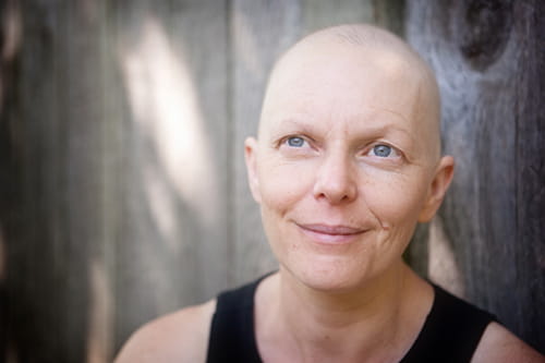 A bald woman smiling 