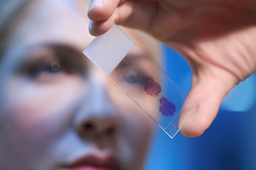 A scientist looking at a blood sample