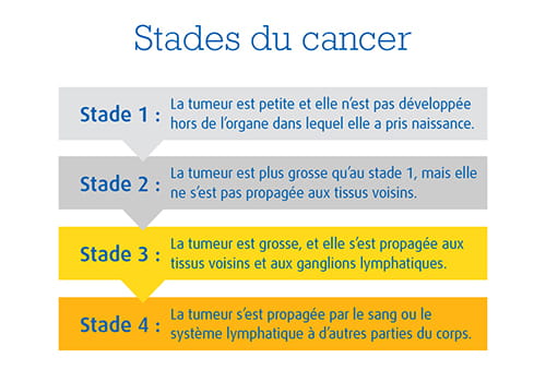Une image expliquant les 4 stades du cancer