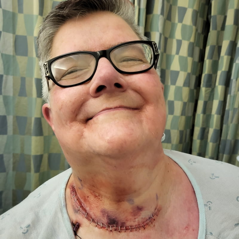 Paula smiling and showing off the scar on her neck.