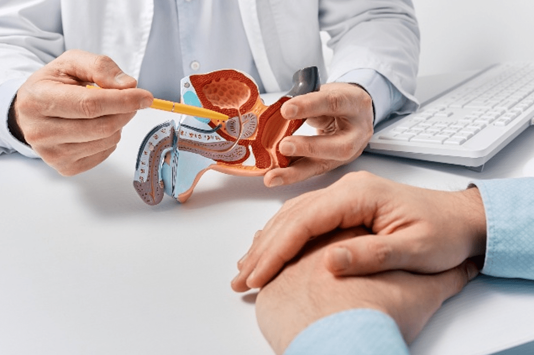A doctor sitting at a desk and showing a patient an anatomical model of the prostate.