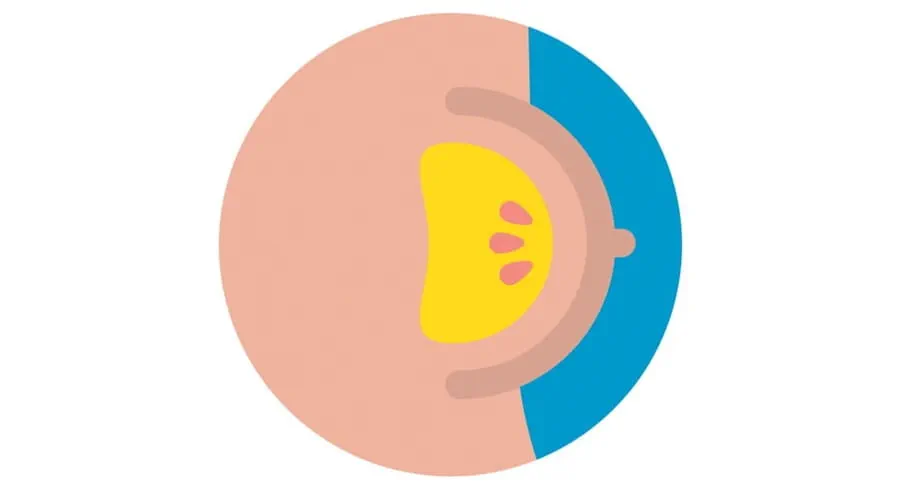 Image of a breast