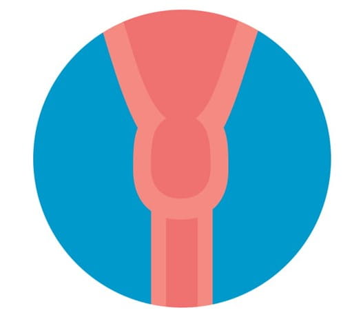 Image of the cervix