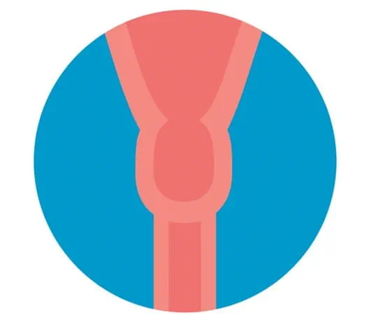 Image du col de l'utérus