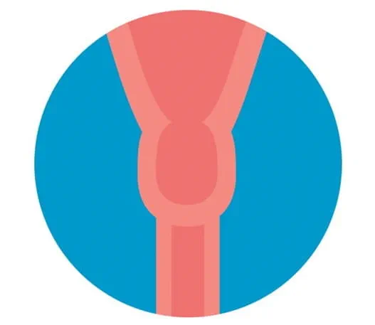 Image of the cervix