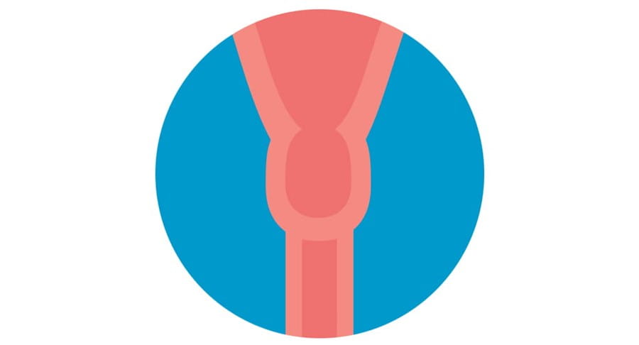 Image of the cervix