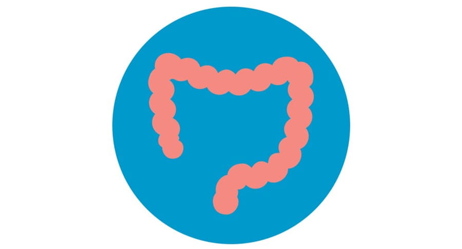 Image of a colon