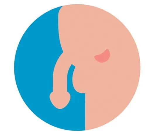Image of the prostate