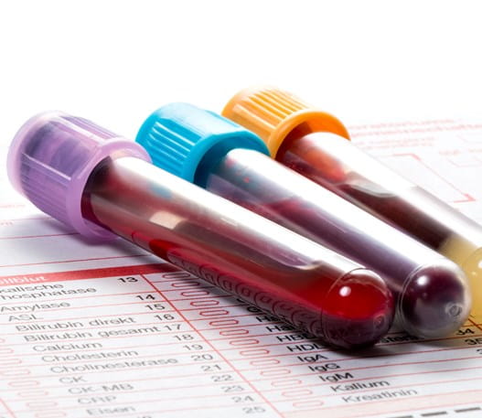 Three vials of blood on top of a lab form