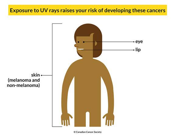 Skin Protection from UV Rays - Care in the Sun