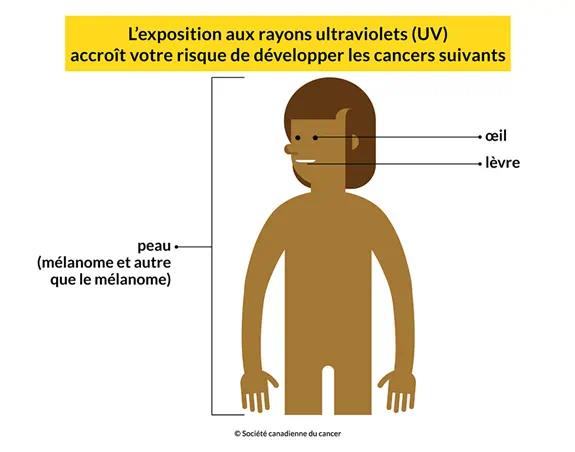 Un corps montrant que l’exposition aux rayons UV accroît le risque de développer les cancers suivants : peau, œil, lèvre