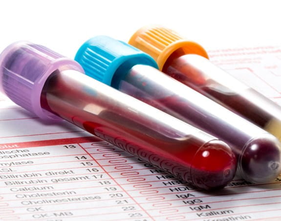 Three vials of blood on top of a lab form