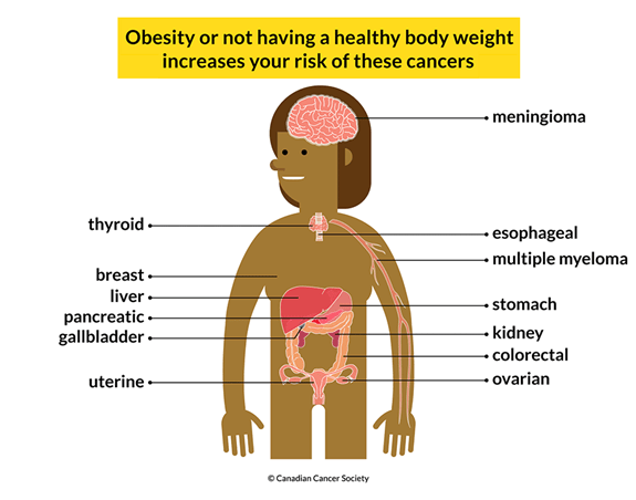 Body labelled with 13 different cancers: breast, colorectal, esophageal, gallbladder, kidney, liver, etc. 