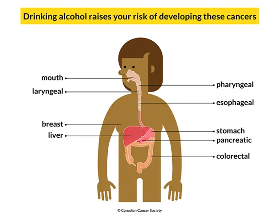 Body showing that drinking alcohol raises your risk of developing mouth, breast, liver and other cancers