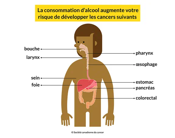 Un corps montrant que la consommation d'alcool augmente votre risque de développer les cancers suivants : bouche, sein, foie et autres