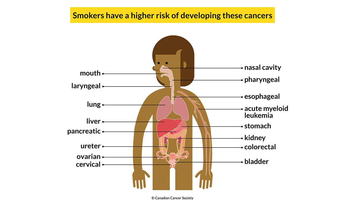 Cigarettes-the Hard Truth | Canadian Cancer Society