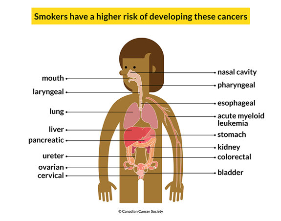 cigarettes-the-hard-truth-canadian-cancer-society