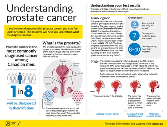 Understanding prostate cancer