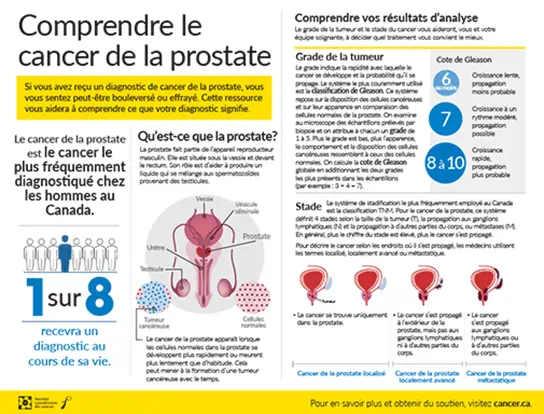 Comprendre le cancer de la prostate