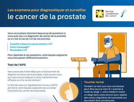 Examens pour diagnostique et surveiller la cancer de la prostate