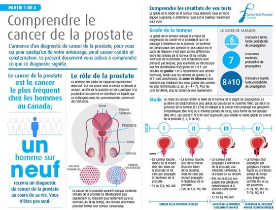 Le paquet "Comprendre le cancer de la prostate"