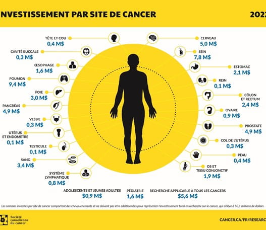 Infographie sur les investissements par site de cancer